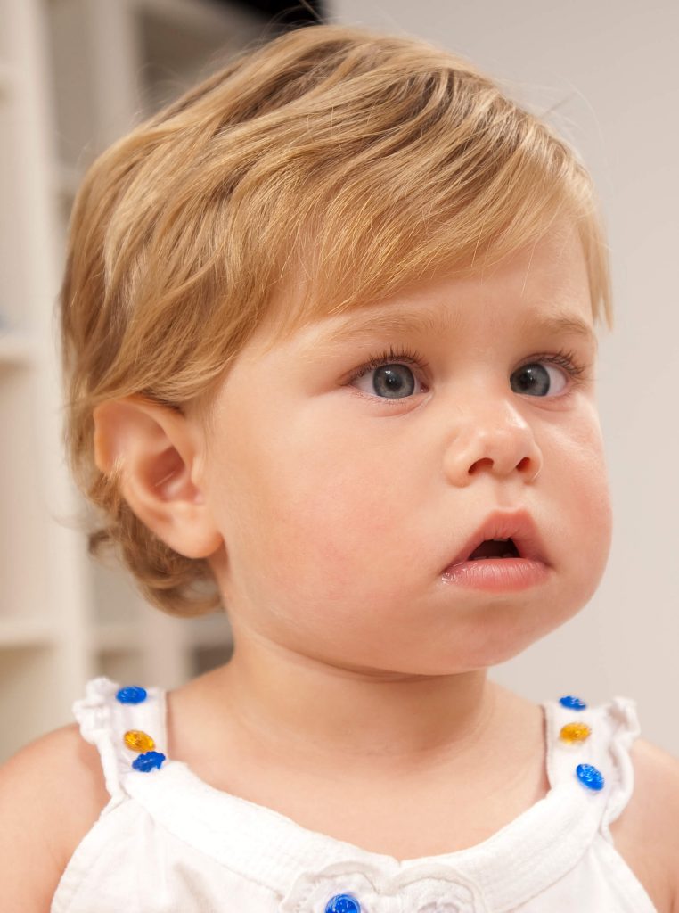 Vision Therapy & Treatment for Strabismus | Microprism Vision
